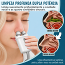 Sistema De Irrigação Nasal Nasalfresh Md Com 30 Pacotes De S